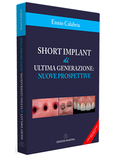 Short Implant Di Ultima Generazione- Nuove Prospettive
